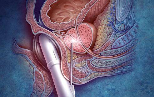 感念父爱 夫妻同查同治共抗不孕‘火狐电竞官网’(图2) 火狐电竞平台